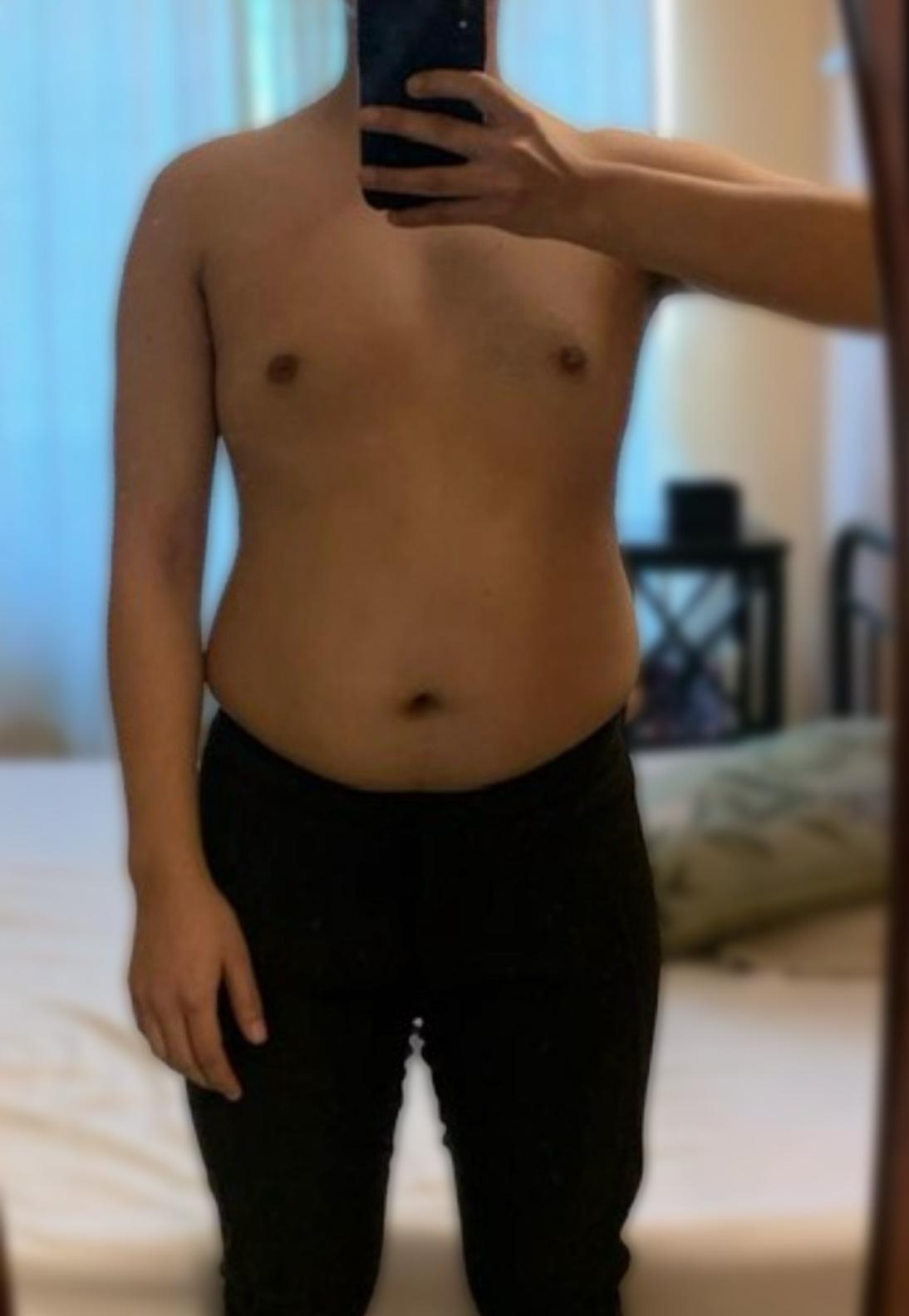 Client before beginning lifestyle coaching.